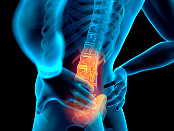spine and back pain prp exosomes stem-cells