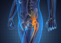 hip_fracture_web